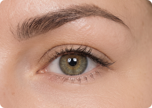 Under eye area after treatment